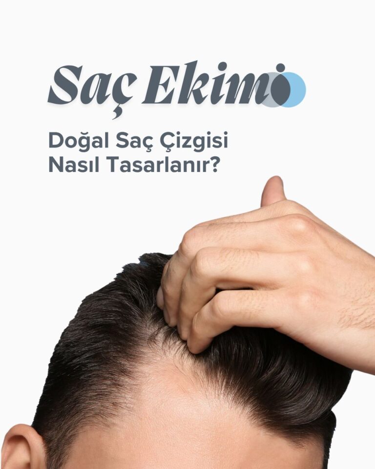 Saç ekiminde doğal saç çizgisi planlamasını anlatan görsel