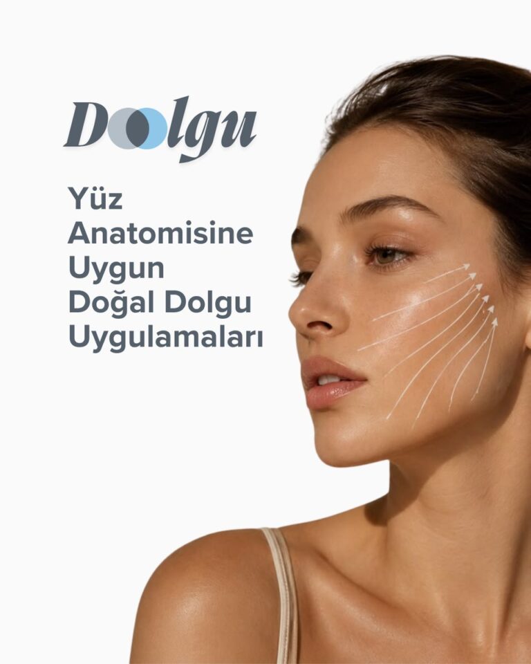 Yüz anatomisine uygun dolgu uygulamasını anlatan görsel